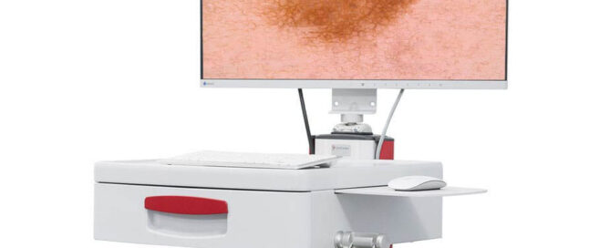 Video dermatoscope LED