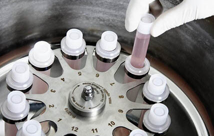 Centrifuga con provette di sangue