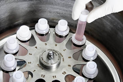Centrifuga con provette di sangue